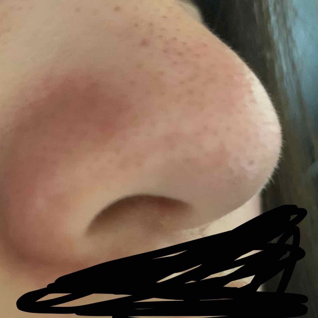 ホワイト もこもこ白泡マスク/リッツ/洗い流すパック・マスクを使ったクチコミ(3枚目)