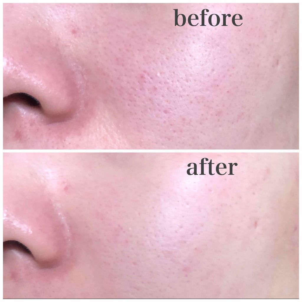 マデカクリーム/センテリアン24/フェイスクリームを使ったクチコミ(2枚目)