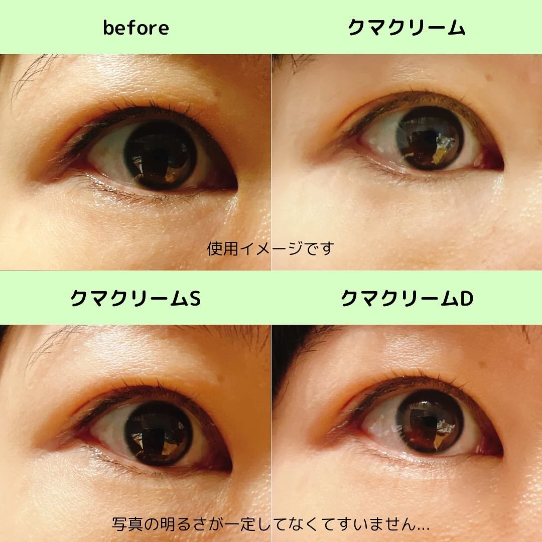 アイレノール クマクリーム/IRENOL/アイケア・アイクリームを使ったクチコミ(7枚目)