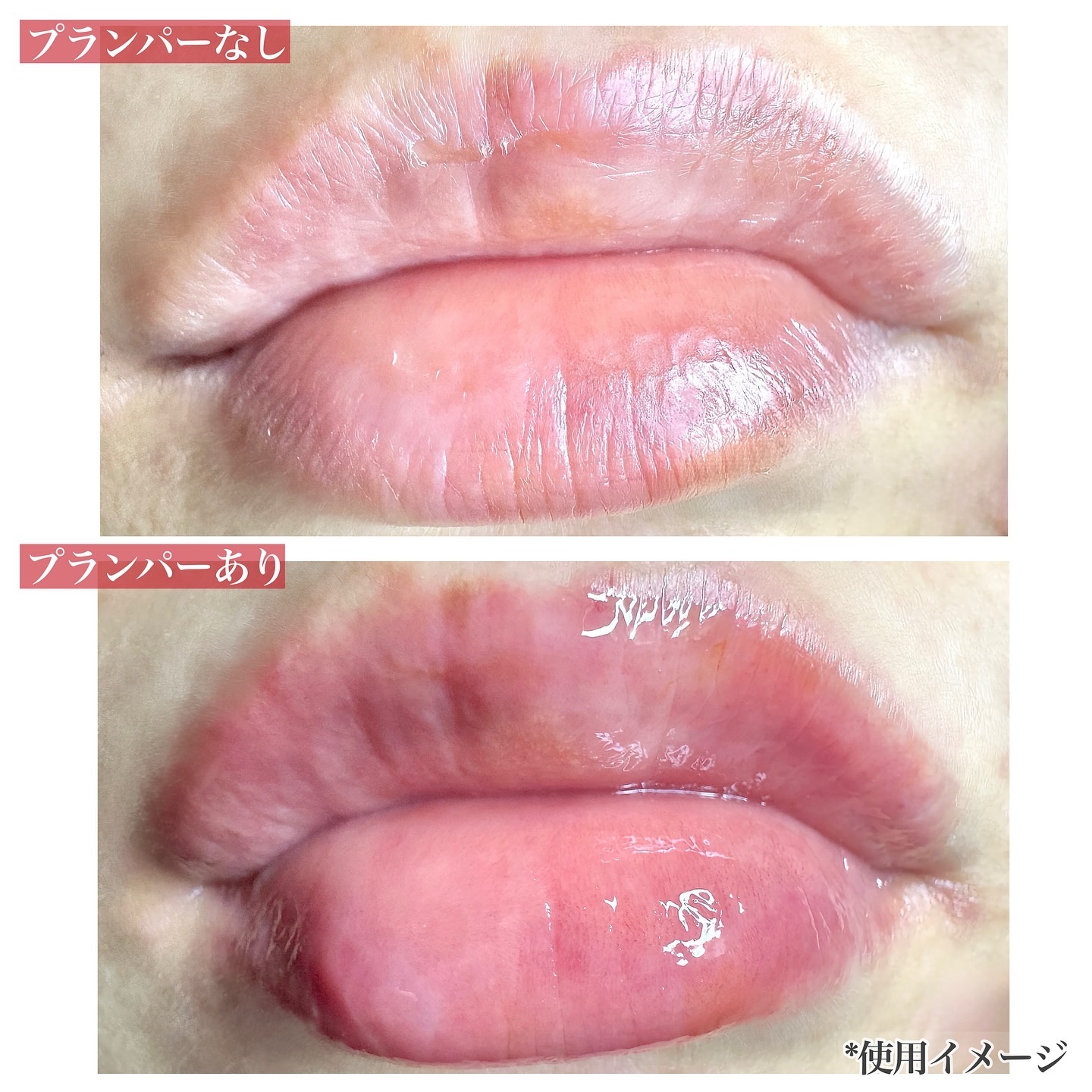 Q+Me　ボムショットリッププランパー+/AGARISM/リッププランパーを使ったクチコミ（3枚目）