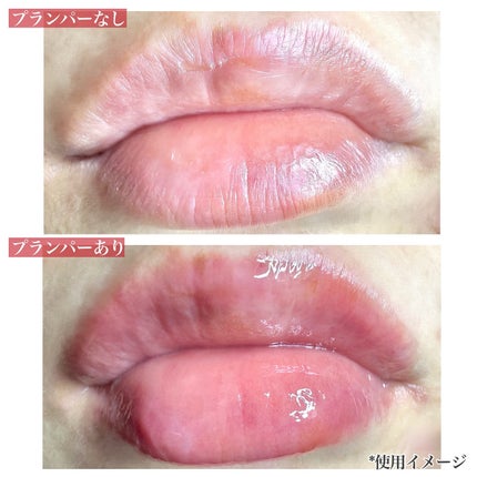 Q+Me ボムショットリッププランパー+/AGARISM/リッププランパーを使ったクチコミ(3枚目)