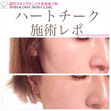 品川スキンクリニック/ノーブランド/その他を使ったクチコミ(1枚目)