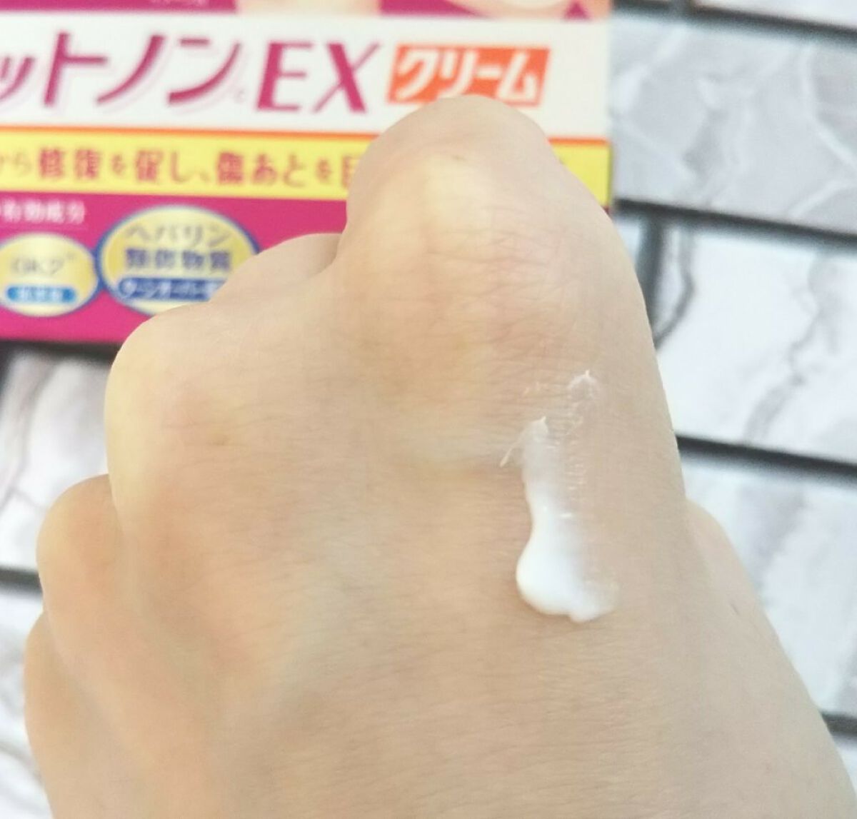 アットノンEX クリーム(医薬品)/アットノン/その他を使ったクチコミ（3枚目）