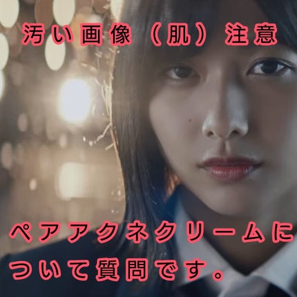 ペアアクネクリームW(医薬品)/ペア/その他を使ったクチコミ(1枚目)