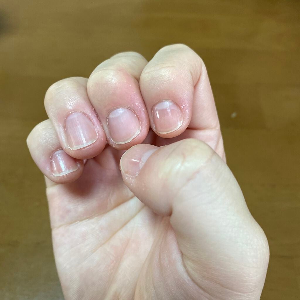 キューティクルネイルオイル ペンタイプ/No nail No life/ネイル用品を使ったクチコミ(5枚目)
