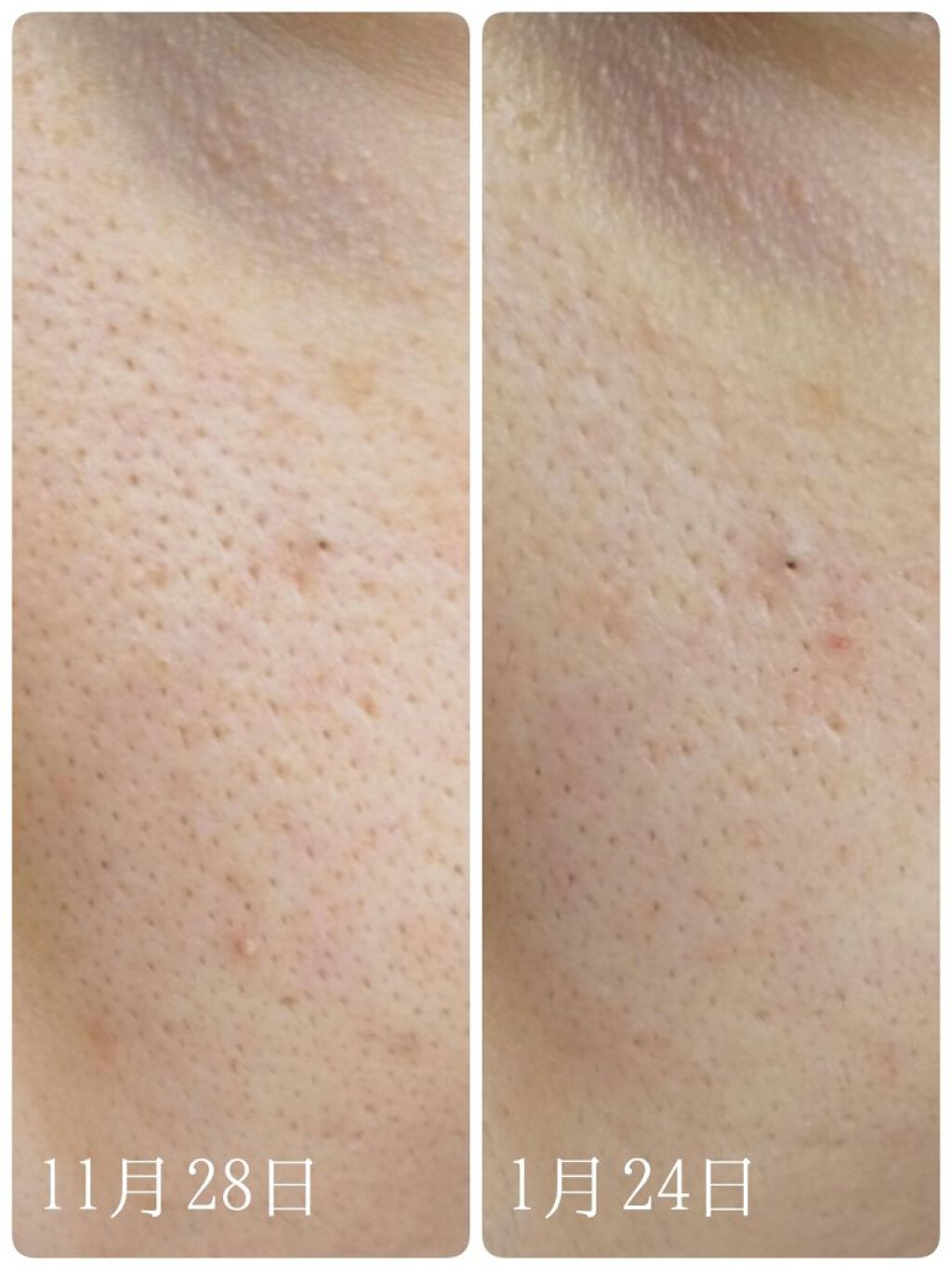 クレージュ クリアクレンジング/CLAYGE/クレンジングジェルを使ったクチコミ（3枚目）