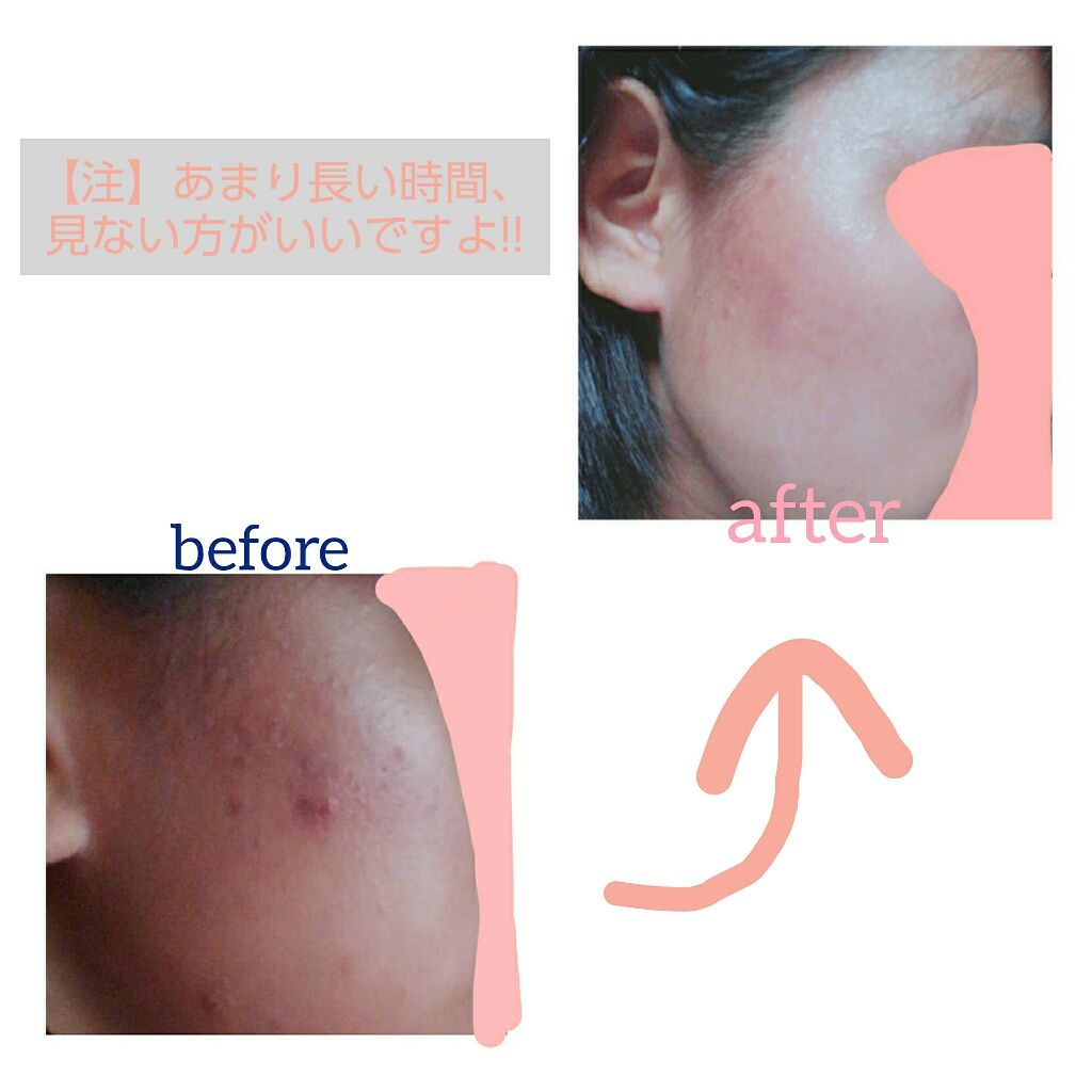 ホットクレンジングゲル/マナラ/クレンジングジェルを使ったクチコミ(2枚目)