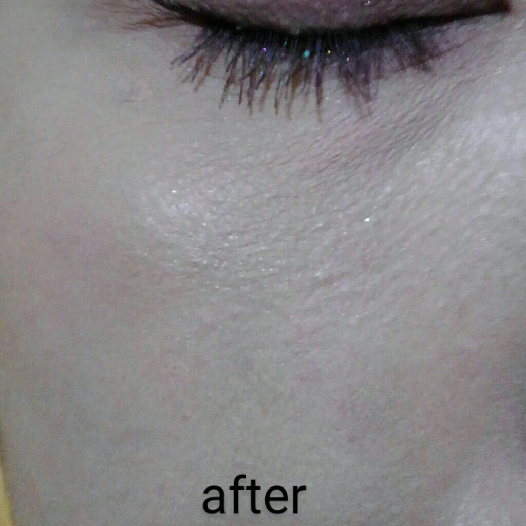 モイスチャー パウダー ファンデーション/ちふれ/パウダーファンデーションを使ったクチコミ(7枚目)