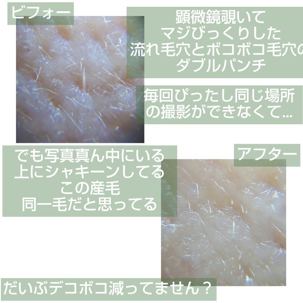 CICA クリーム/VT/フェイスクリームを使ったクチコミ(9枚目)