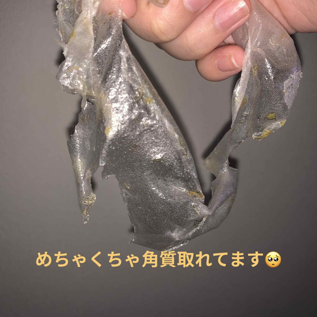 リアルカレンデュラピールオフパック/APRILSKIN/ピーリングを使ったクチコミ(3枚目)