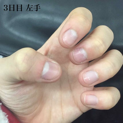 ピンクピンク on LIPS 「みなさんこんにちはこんばんは今日は爪を噛んでしまう癖をなくそう..」(1枚目)