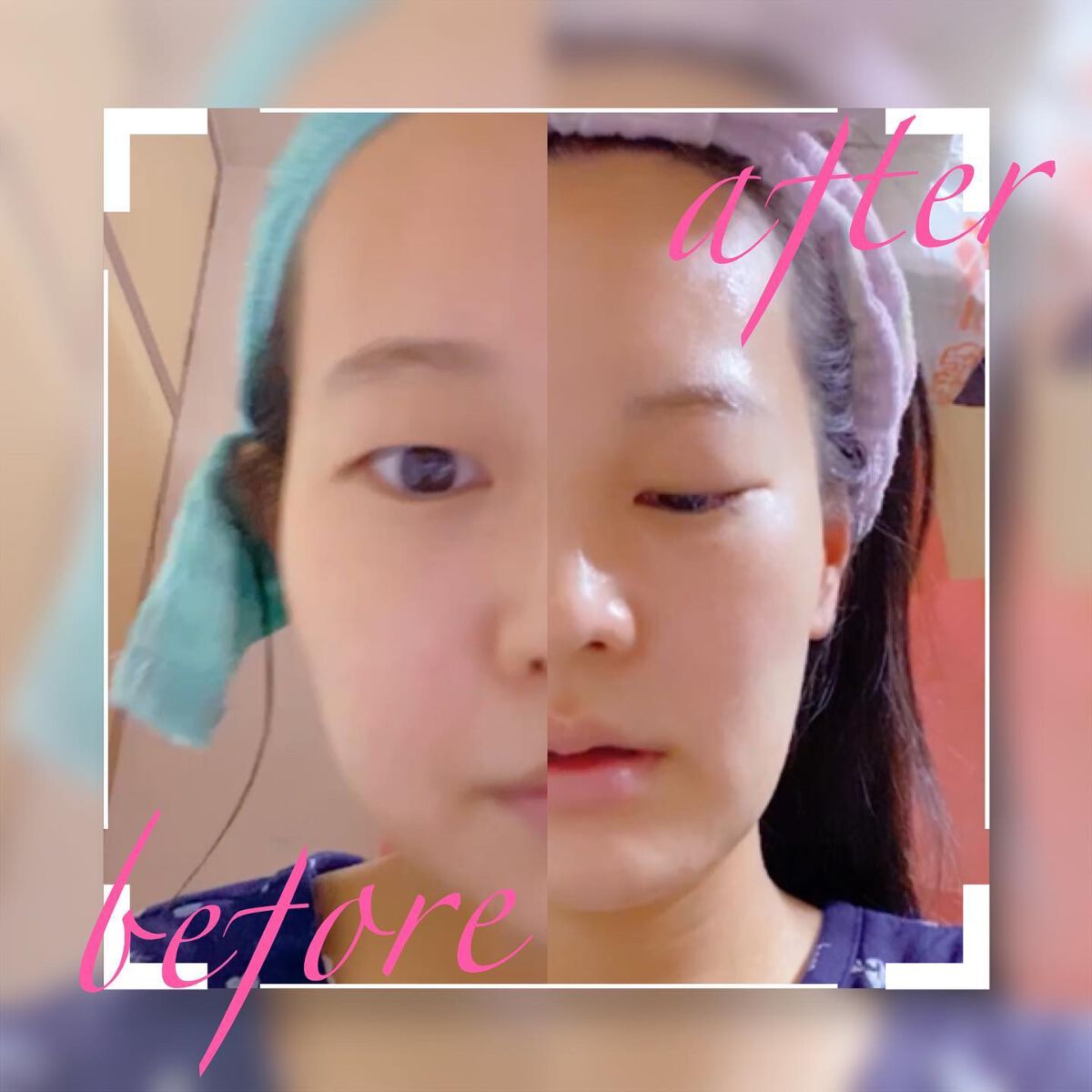 BPマルチスキンケア密着浸透3D美容液パック/Bella Pelle/シートマスク・パックを使ったクチコミ(4枚目)