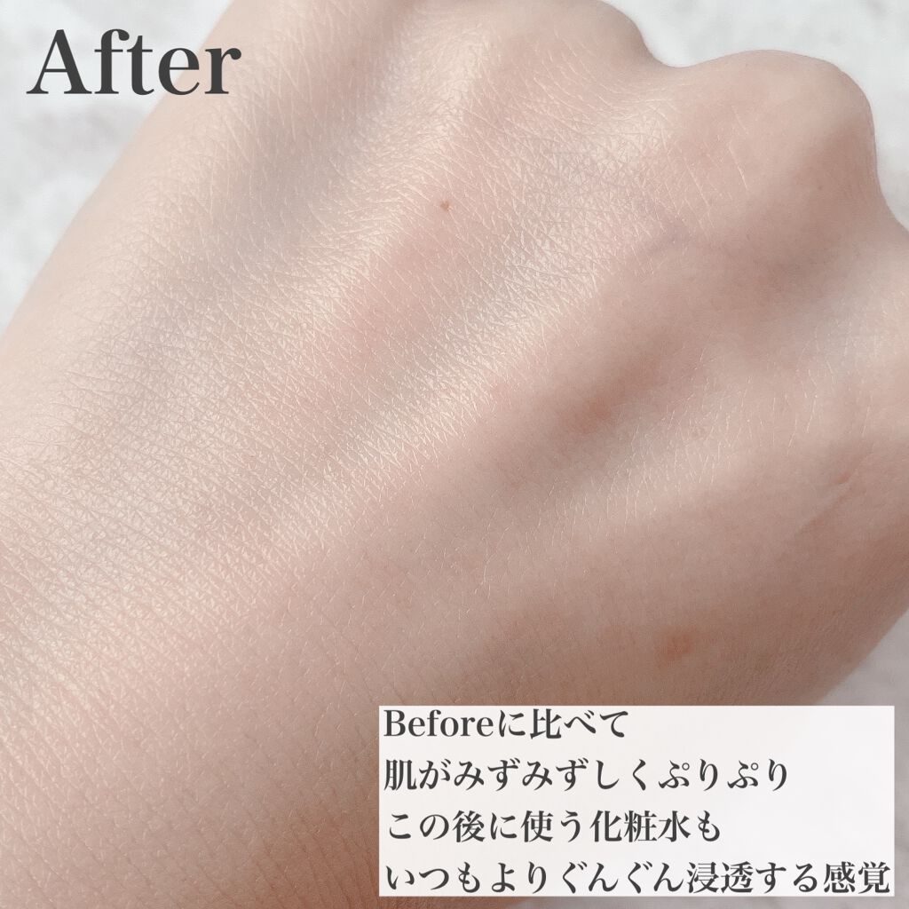 ピーリングブースターウォータリー/CNP Laboratory/化粧水を使ったクチコミ(5枚目)