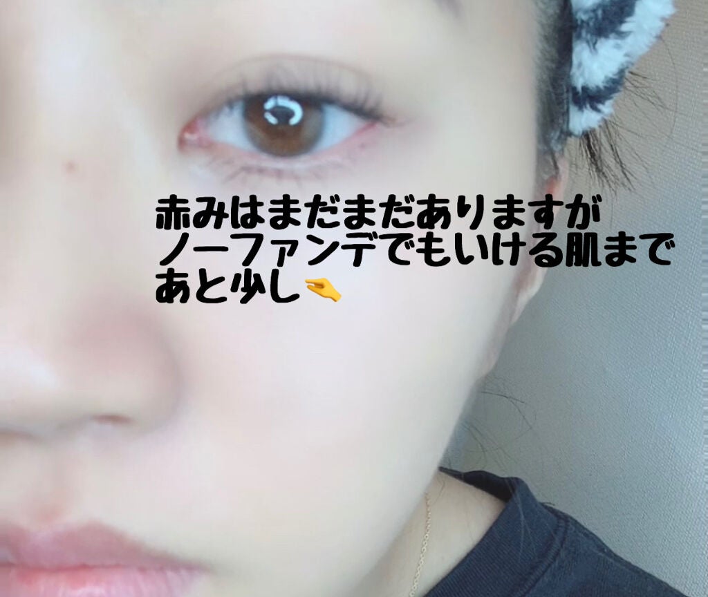 グリーンタンジェリン ビタC ダークスポットケアセラム/goodal/美容液を使ったクチコミ(2枚目)