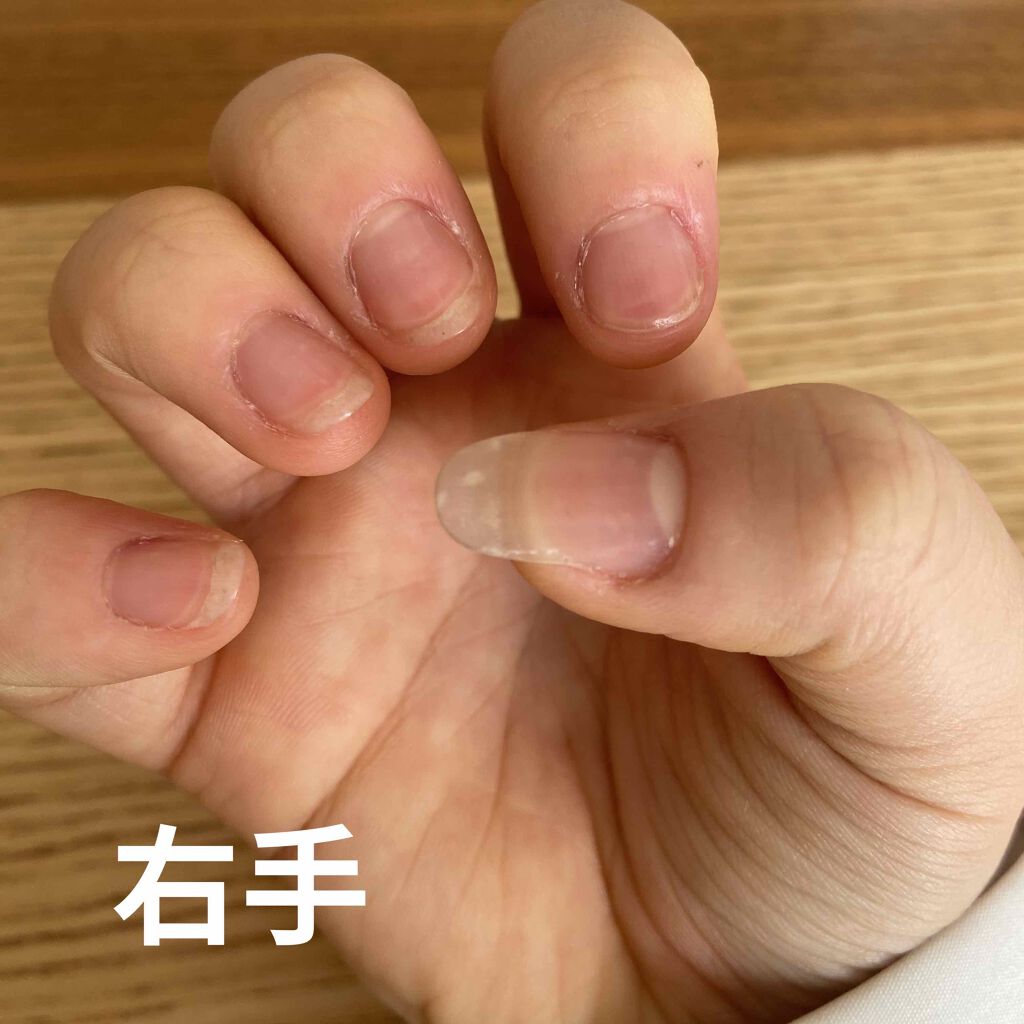 アロマキューティクルオイル/D-UP/ネイルオイル・トリートメントを使ったクチコミ（3枚目）