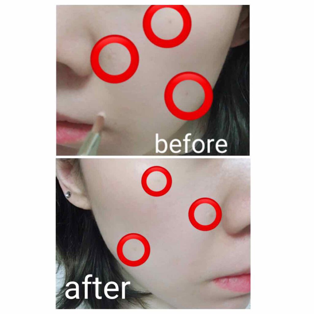 シミ隠しマジックパレット/シミウス/パレットコンシーラーを使ったクチコミ（3枚目）