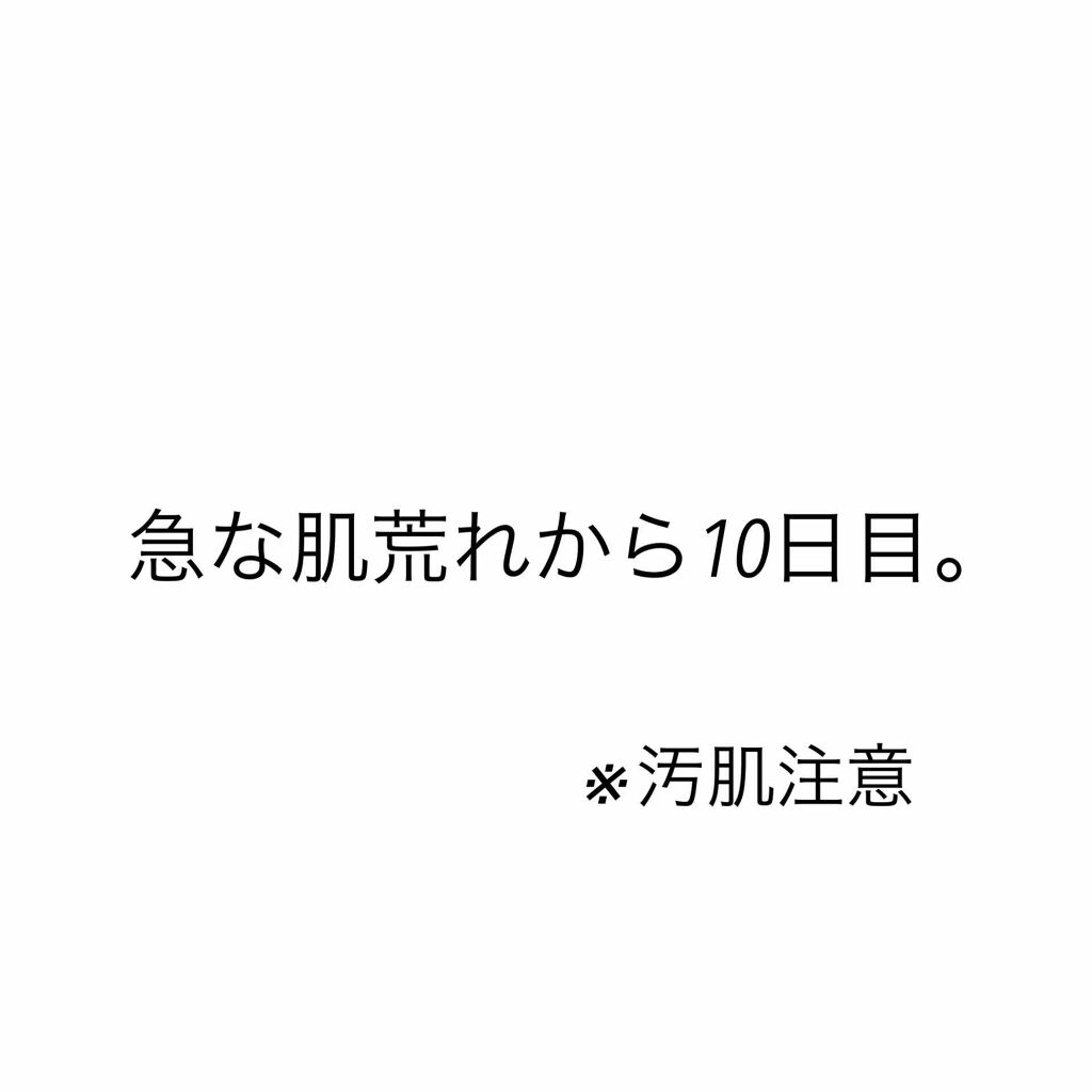 明色美顔水 薬用化粧水/美顔/化粧水を使ったクチコミ（1枚目）