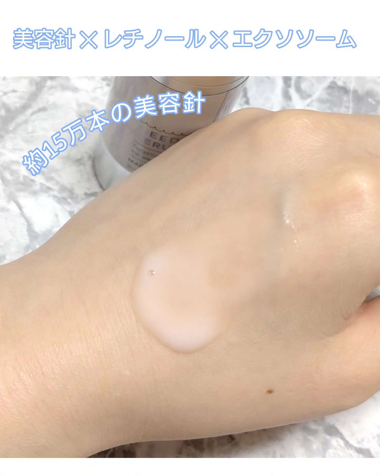 ニードルセラムA/fractionalCC/美容液を使ったクチコミ（2枚目）