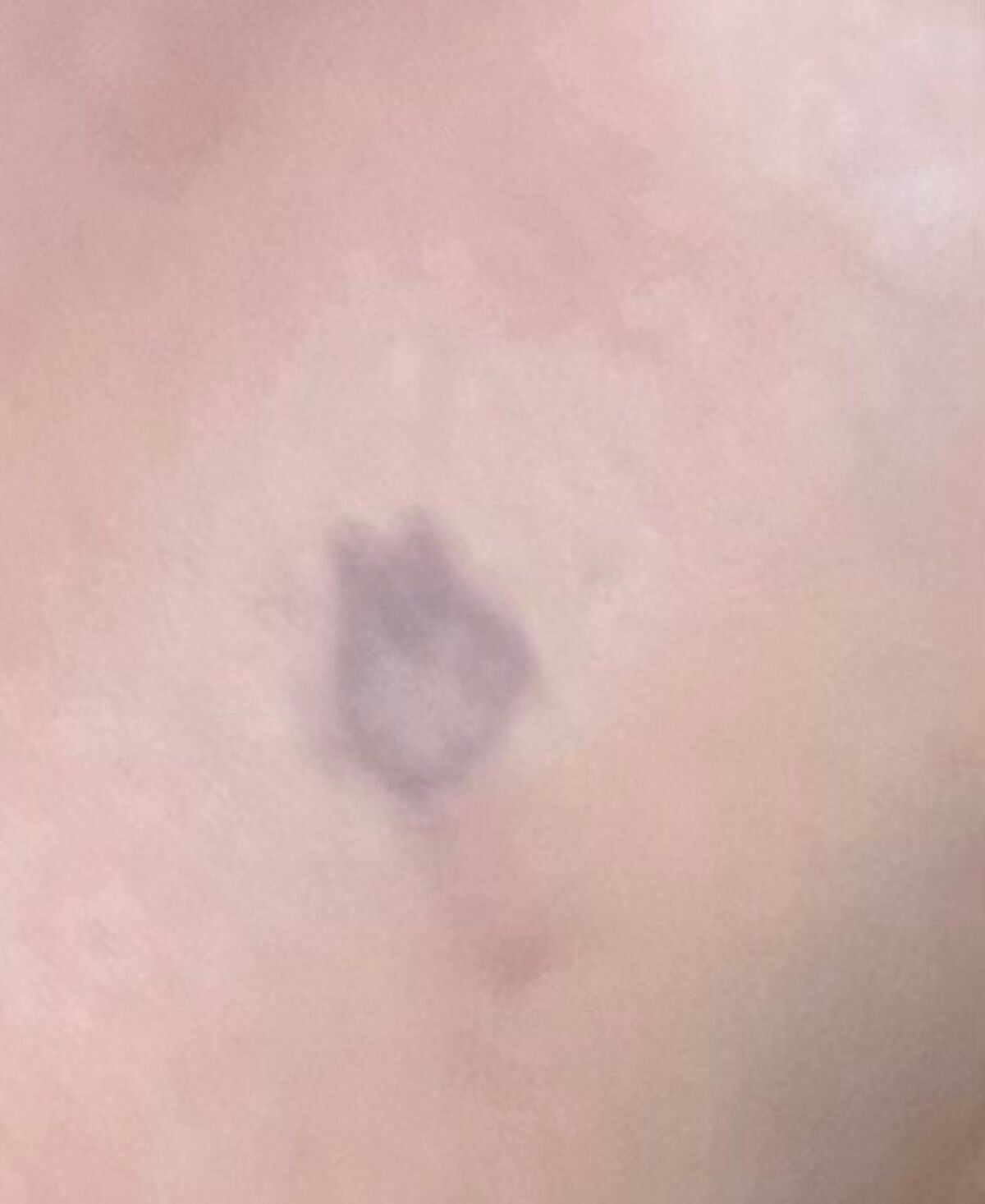 フローレス フュージョン ウルトラ ロングウェア コンシーラー/ローラ メルシエ/リキッドコンシーラーを使ったクチコミ(2枚目)