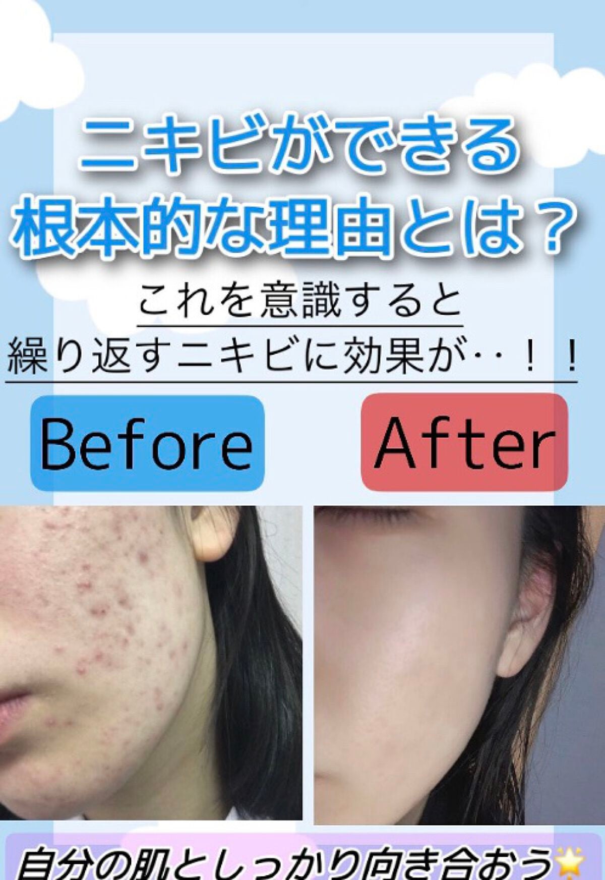 プレミア敏感肌用 Lディスポ/シック/シェーバーを使ったクチコミ(1枚目)