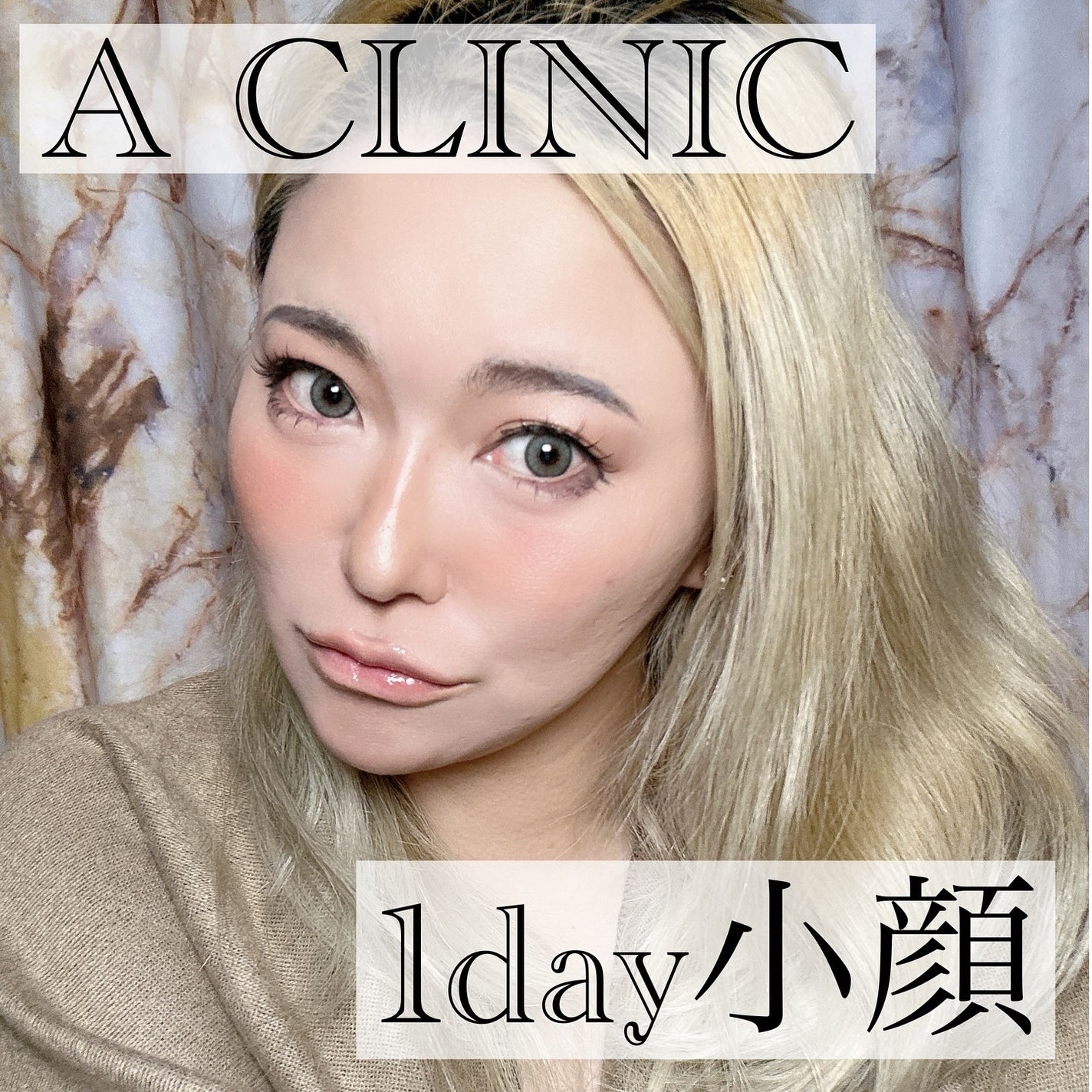 5児ママ ゆかこ♡フォロバ100 コメください on LIPS 「@a_clinic_sendaiにいってきました♡こんにちは女..」(1枚目)