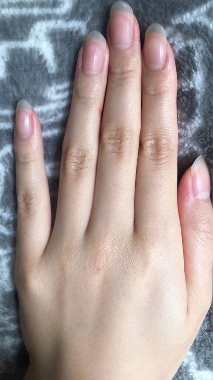 ネイルベッドオイル/アンドネイル/ネイルオイル・トリートメントを使ったクチコミ(3枚目)