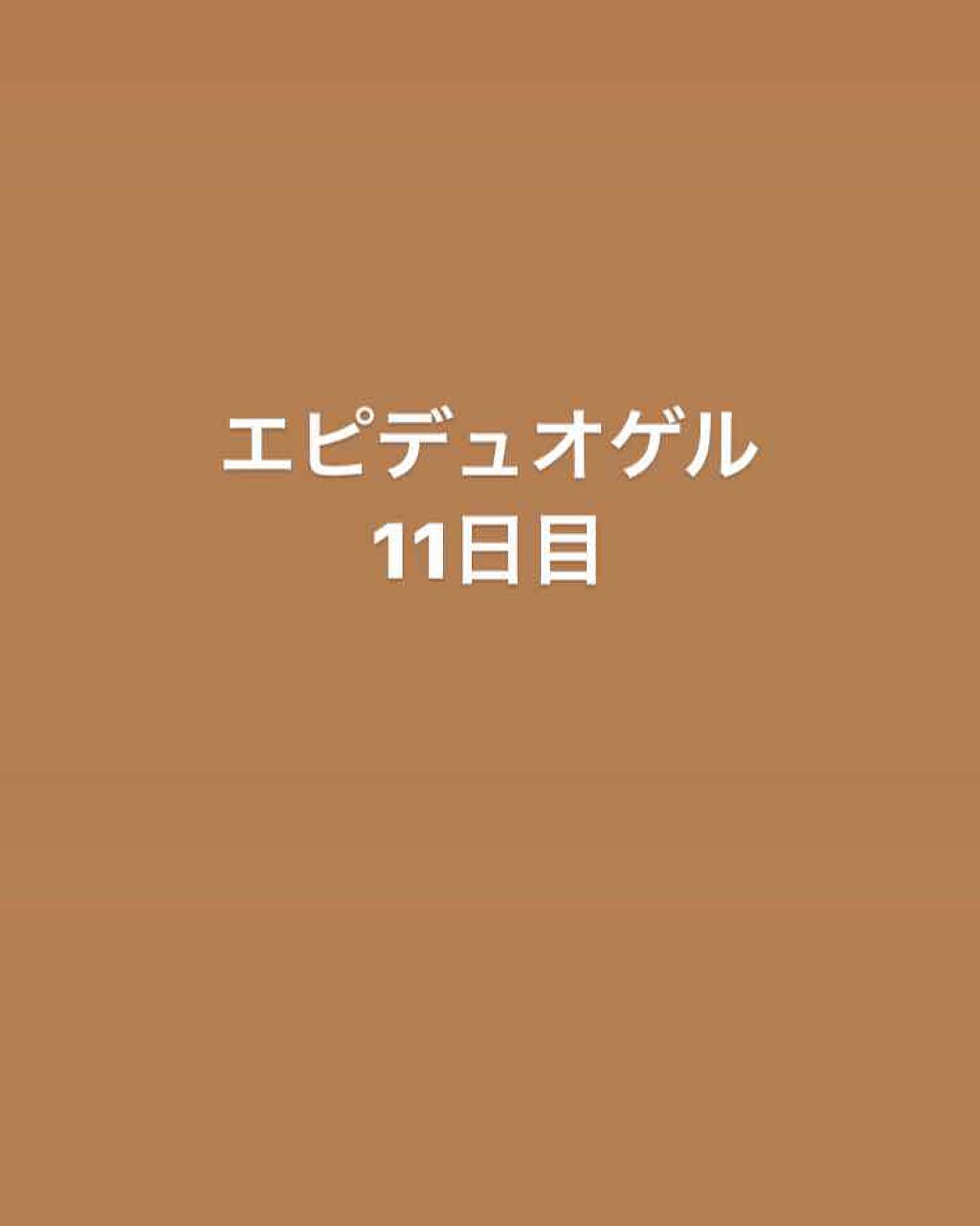 エピデュオゲル/マルホ株式会社/その他を使ったクチコミ（1枚目）