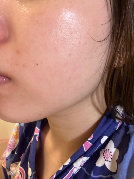 薬用洗顔フォーム/スキンライフ/洗顔フォームを使ったクチコミ(4枚目)