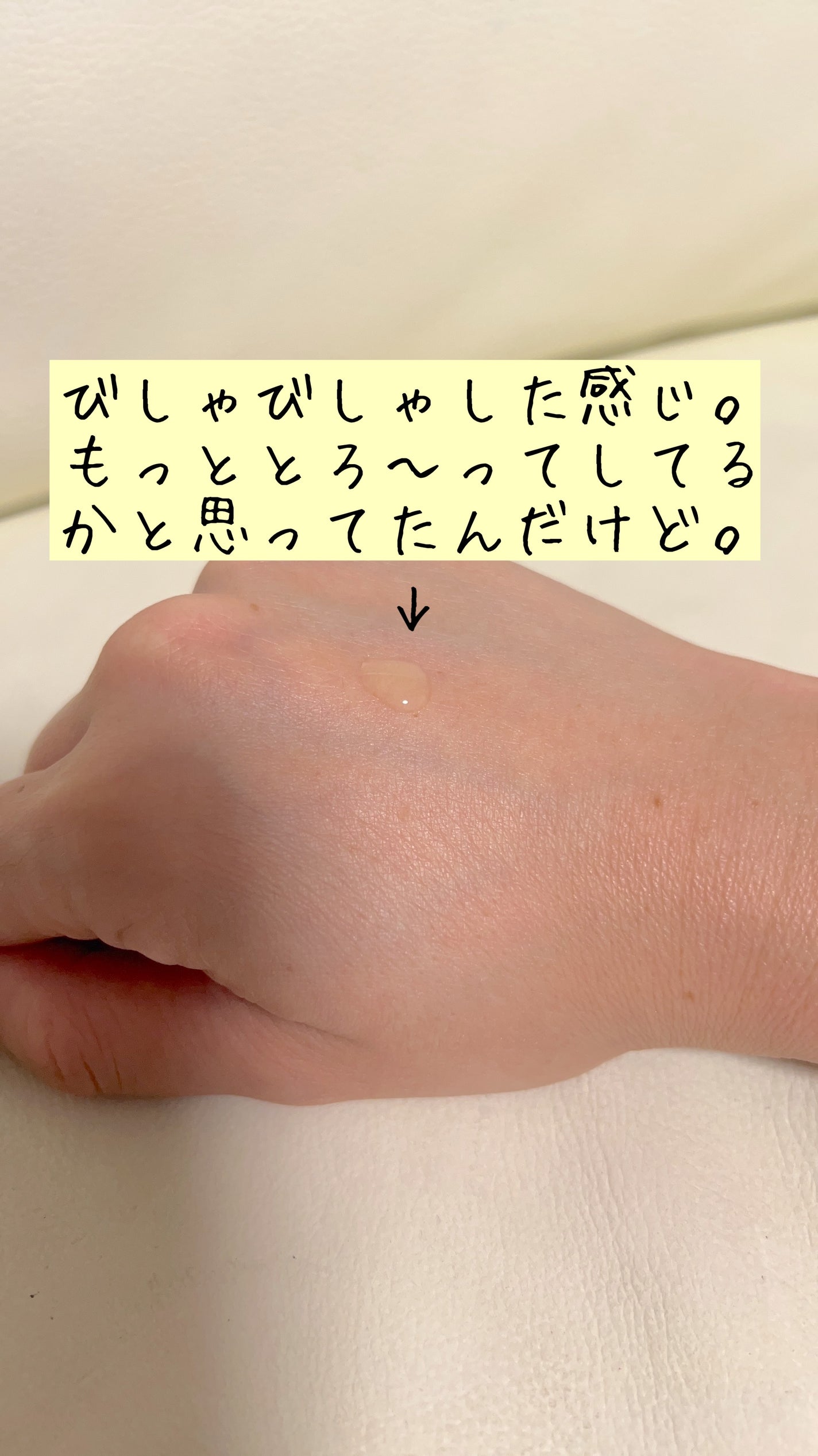 ダーマレーザー ウルセラR/クオリティファースト/美容液を使ったクチコミ(3枚目)