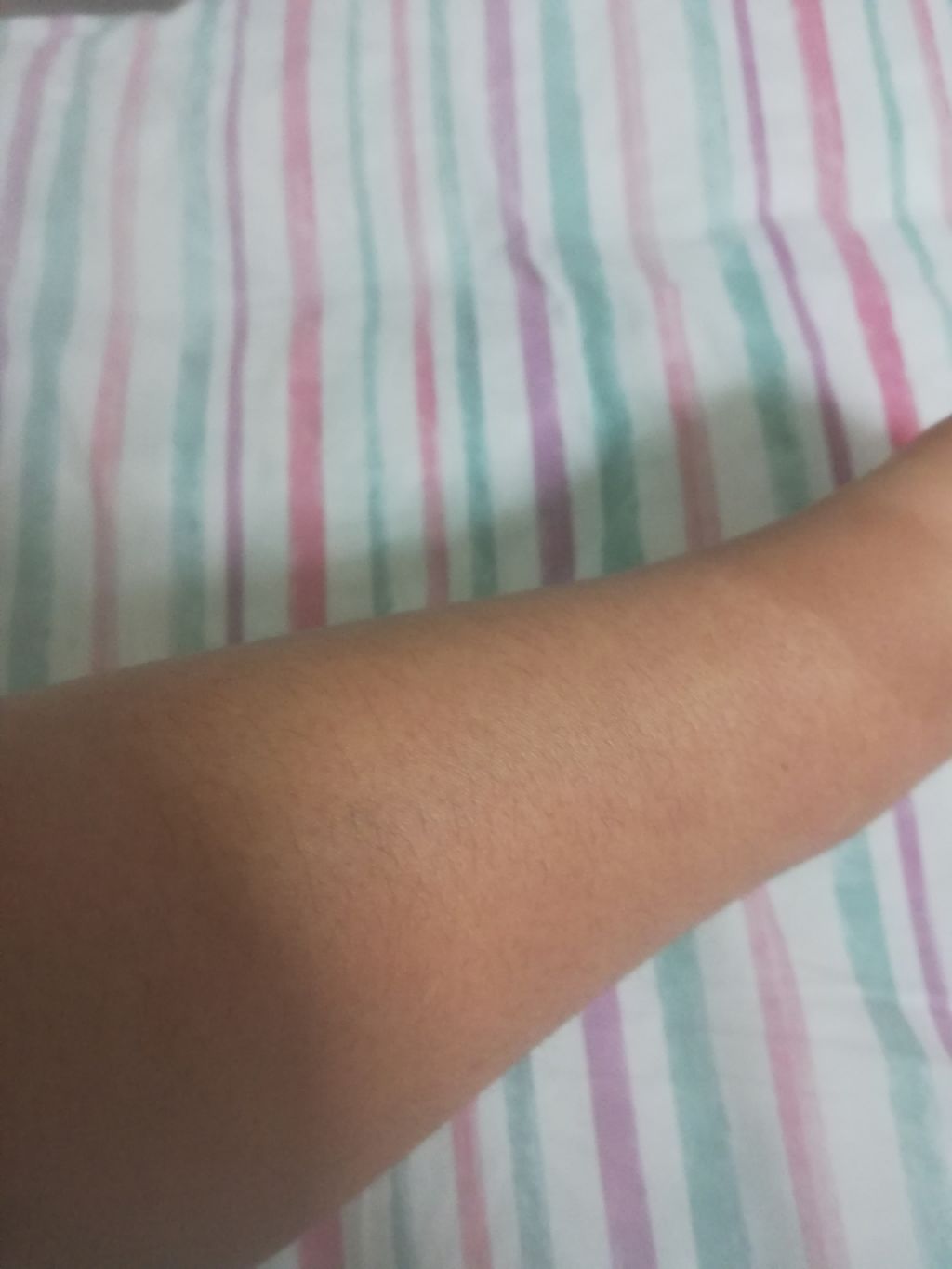 DHC ビタミンCハードカプセル/DHC/美容サプリメントを使ったクチコミ(2枚目)