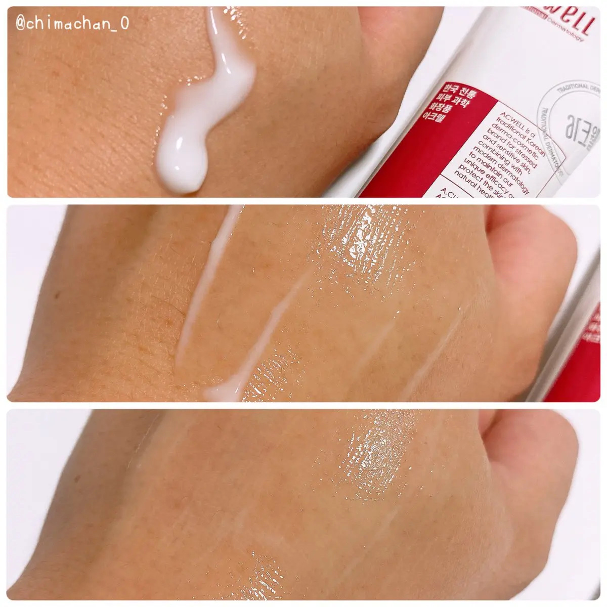 アキュリアルナインコントロールエックスクリーム/ACWELL/フェイスクリームを使ったクチコミ（2枚目）