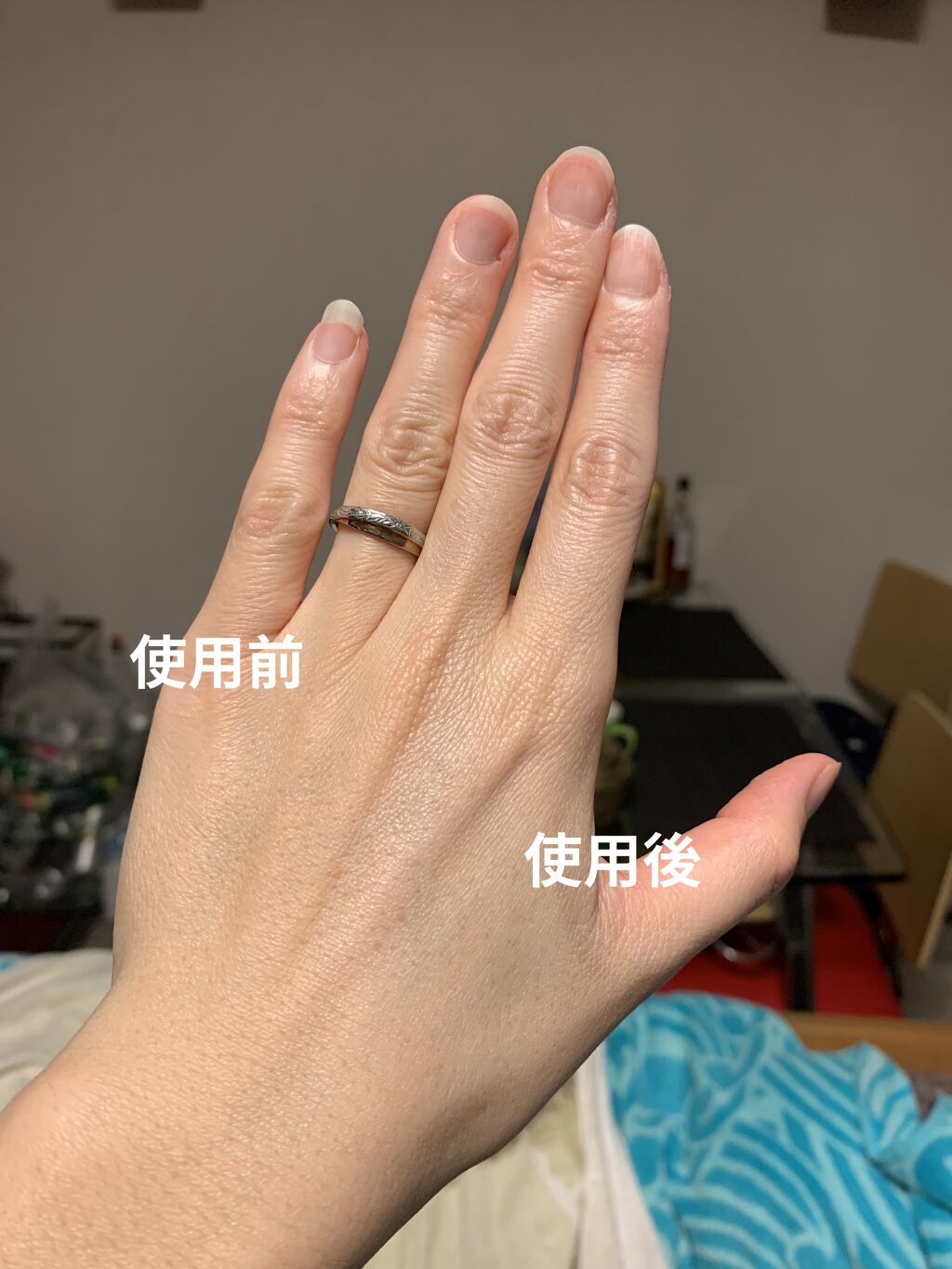 デュイセル ターンオンクリーム/DEWYCEL/フェイスクリームを使ったクチコミ（2枚目）