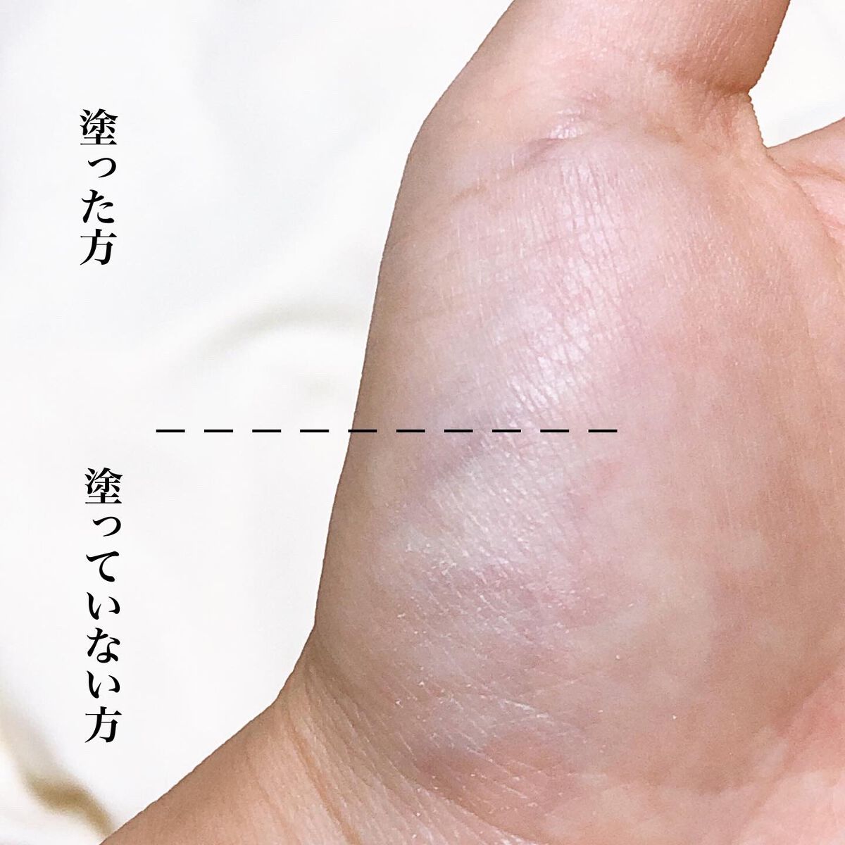 薬用 スキンケア パウダー/アクネオ/プレストパウダーを使ったクチコミ(5枚目)