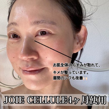 ジョワセリュール セラム/JOIE CELLULE/美容液を使ったクチコミ（8枚目）