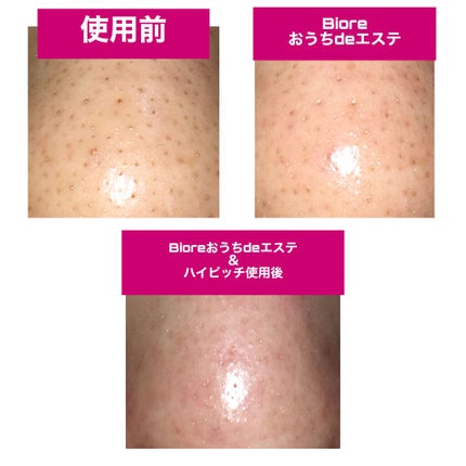 ディープクレンジングオイルW/ハイピッチ/オイルクレンジングを使ったクチコミ(3枚目)