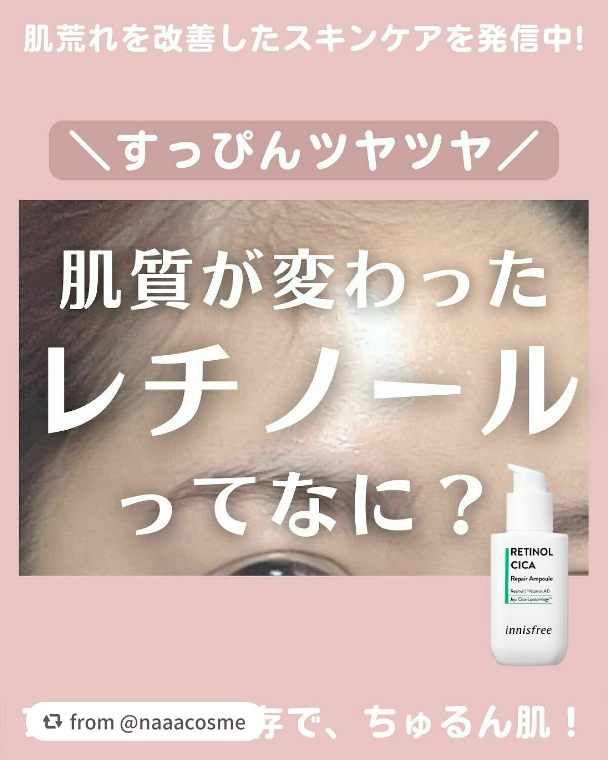 レチノール シカ リペア セラム/innisfree/美容液を使ったクチコミ(1枚目)