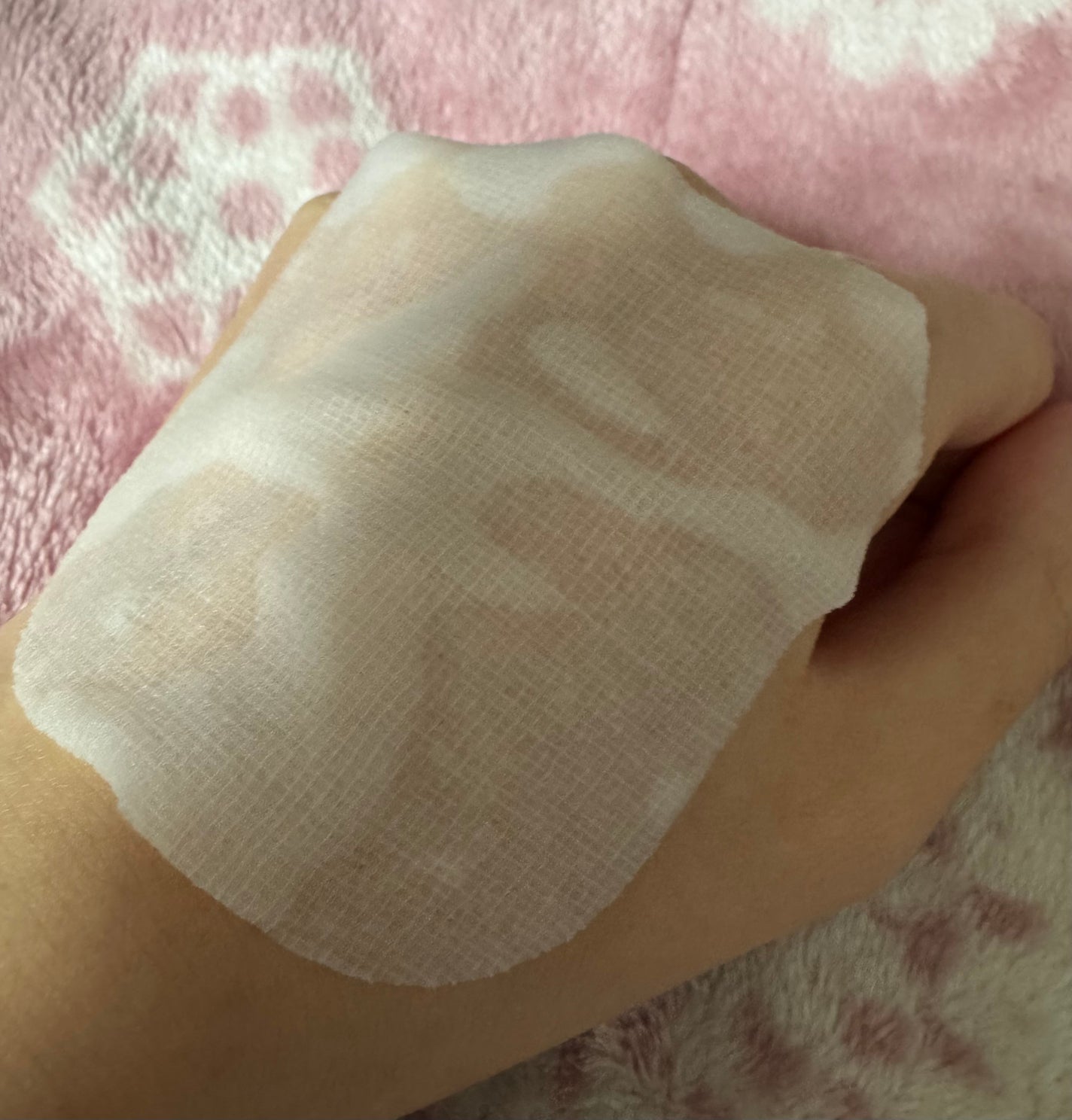 マデカソサイド ブレミッシュパッド/MEDIHEAL/トナーパッドを使ったクチコミ(3枚目)