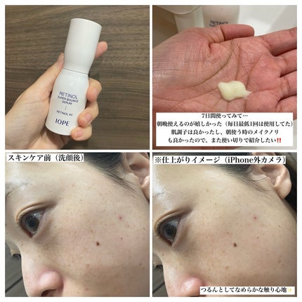 レチノール スーパーバウンス セラム/IOPE/美容液を使ったクチコミ(2枚目)