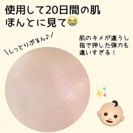 my's パーソナライズセラム/my's/美容液を使ったクチコミ(3枚目)