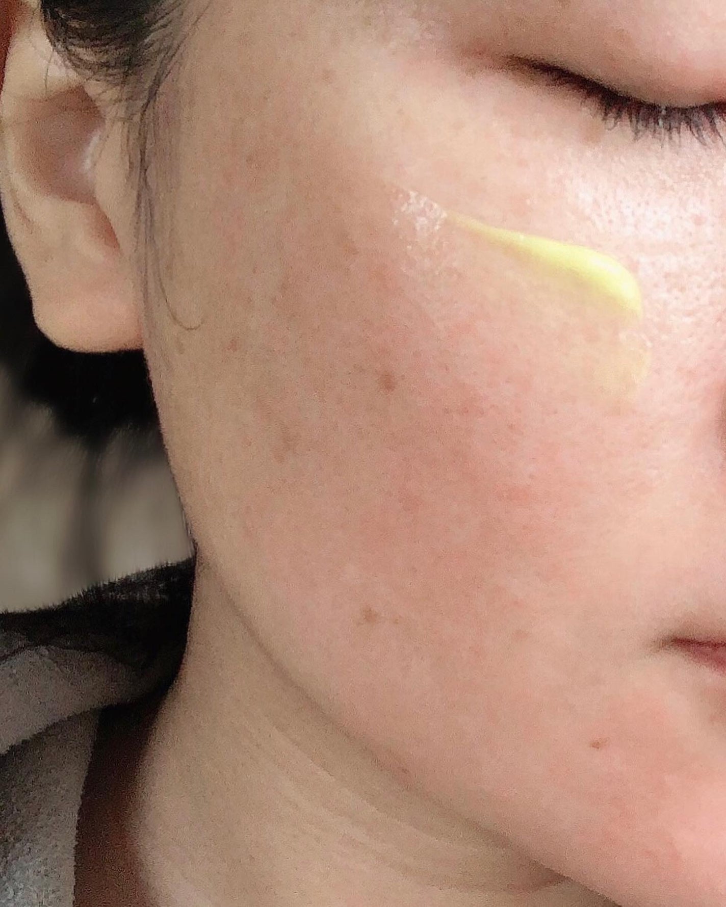 シカレチA エッセンス0.3/VT/美容液を使ったクチコミ(5枚目)