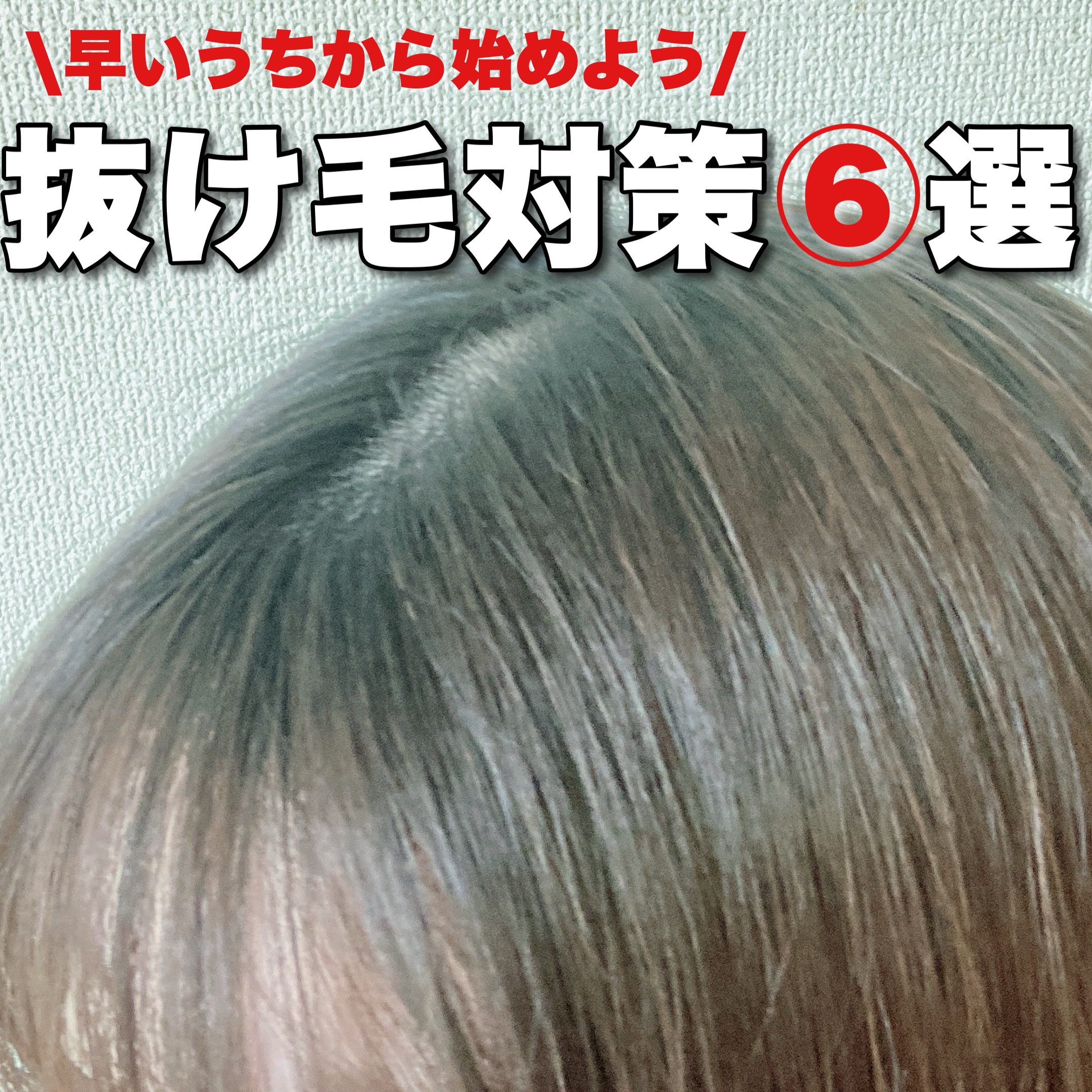 頭皮保湿ローション/キュレル/頭皮ローションを使ったクチコミ（1枚目）