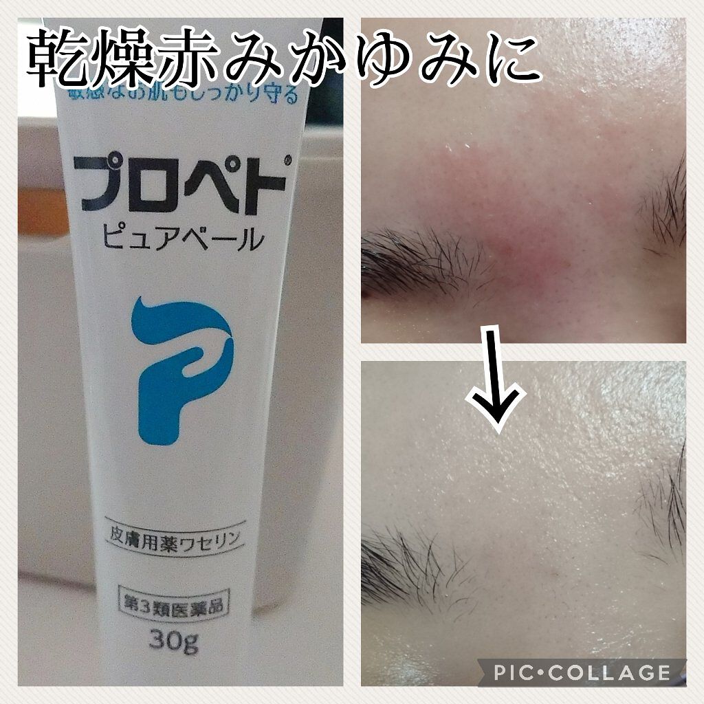 ピュアベール(医薬品)/プロペト/その他を使ったクチコミ(1枚目)