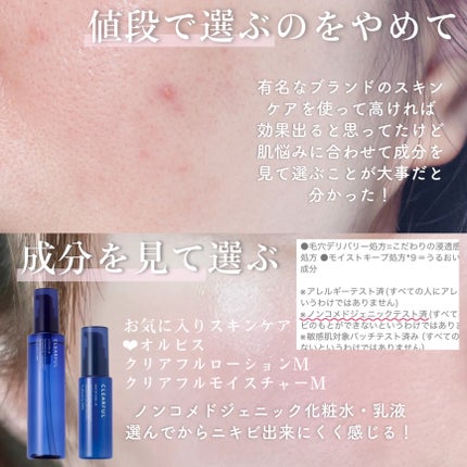 クリアリーソープ(AHA)/エクスピュール/洗顔石鹸を使ったクチコミ(4枚目)