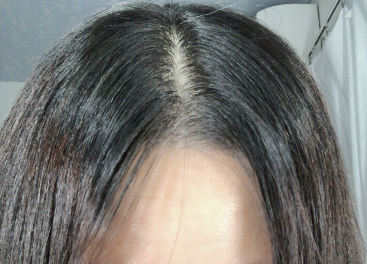 DHC 亜鉛/DHC/健康サプリメントを使ったクチコミ（3枚目）