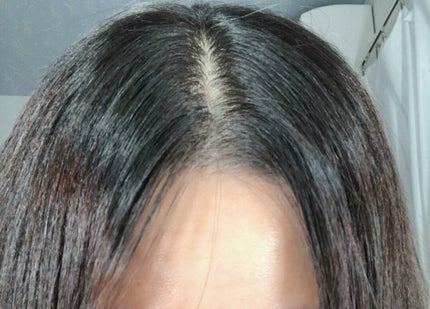 DHC 亜鉛/DHC/健康サプリメントを使ったクチコミ(3枚目)