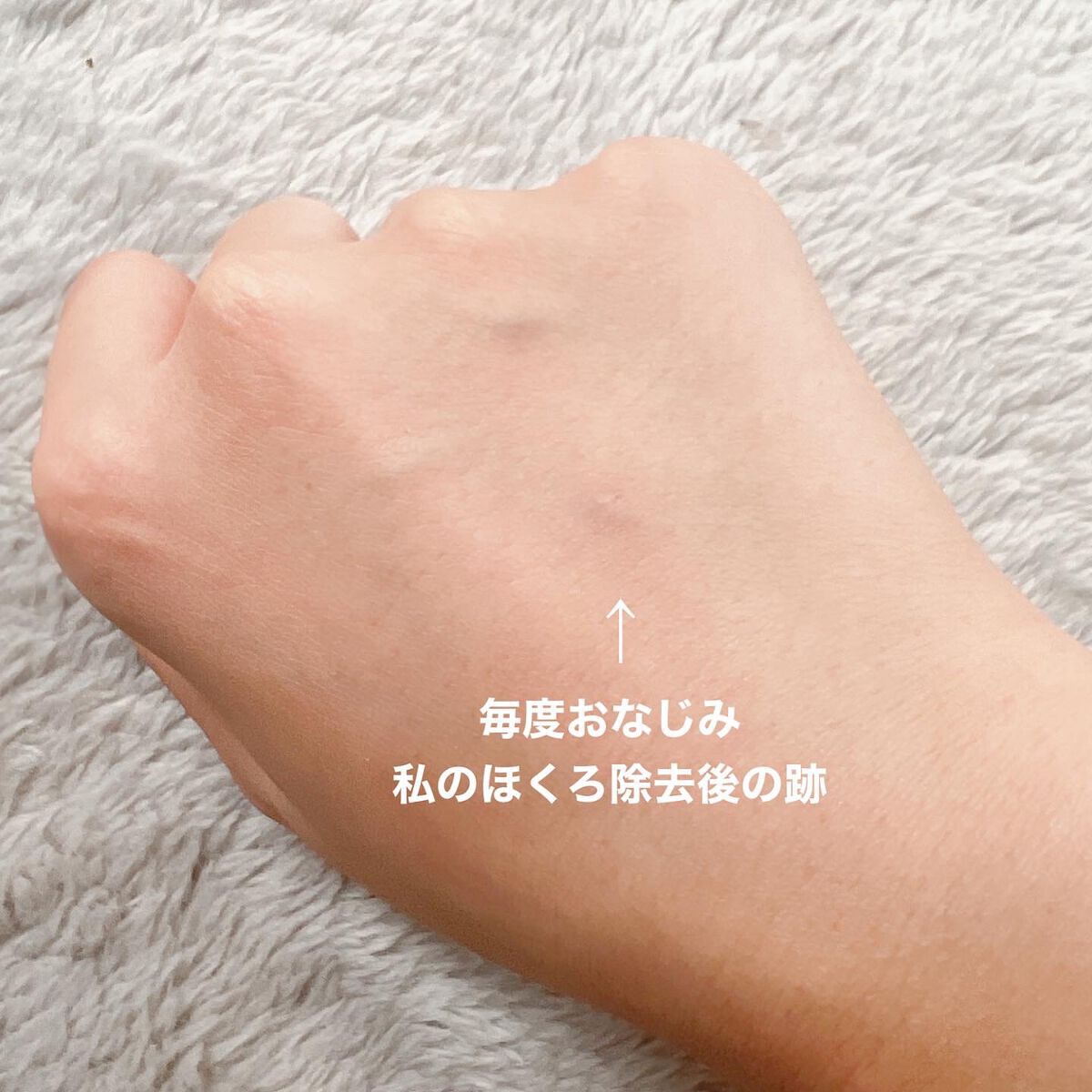 マーシュフィールド SC ボディカバーファンデN/マーシュ・フィールド/クリーム・エマルジョンファンデーションを使ったクチコミ(3枚目)