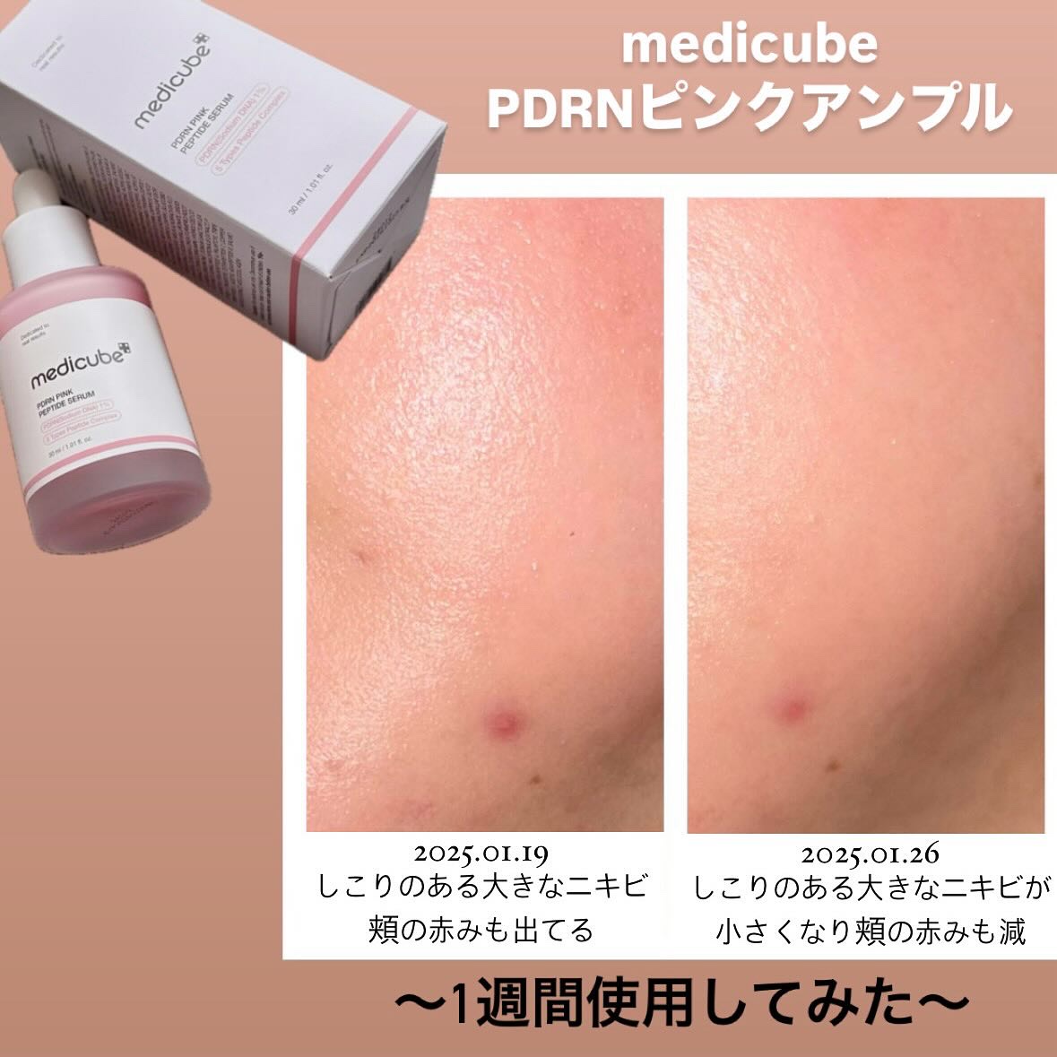 PDRNピンクアンプル PDRN 10,000ppm配合/MEDICUBE/美容液を使ったクチコミ（2枚目）
