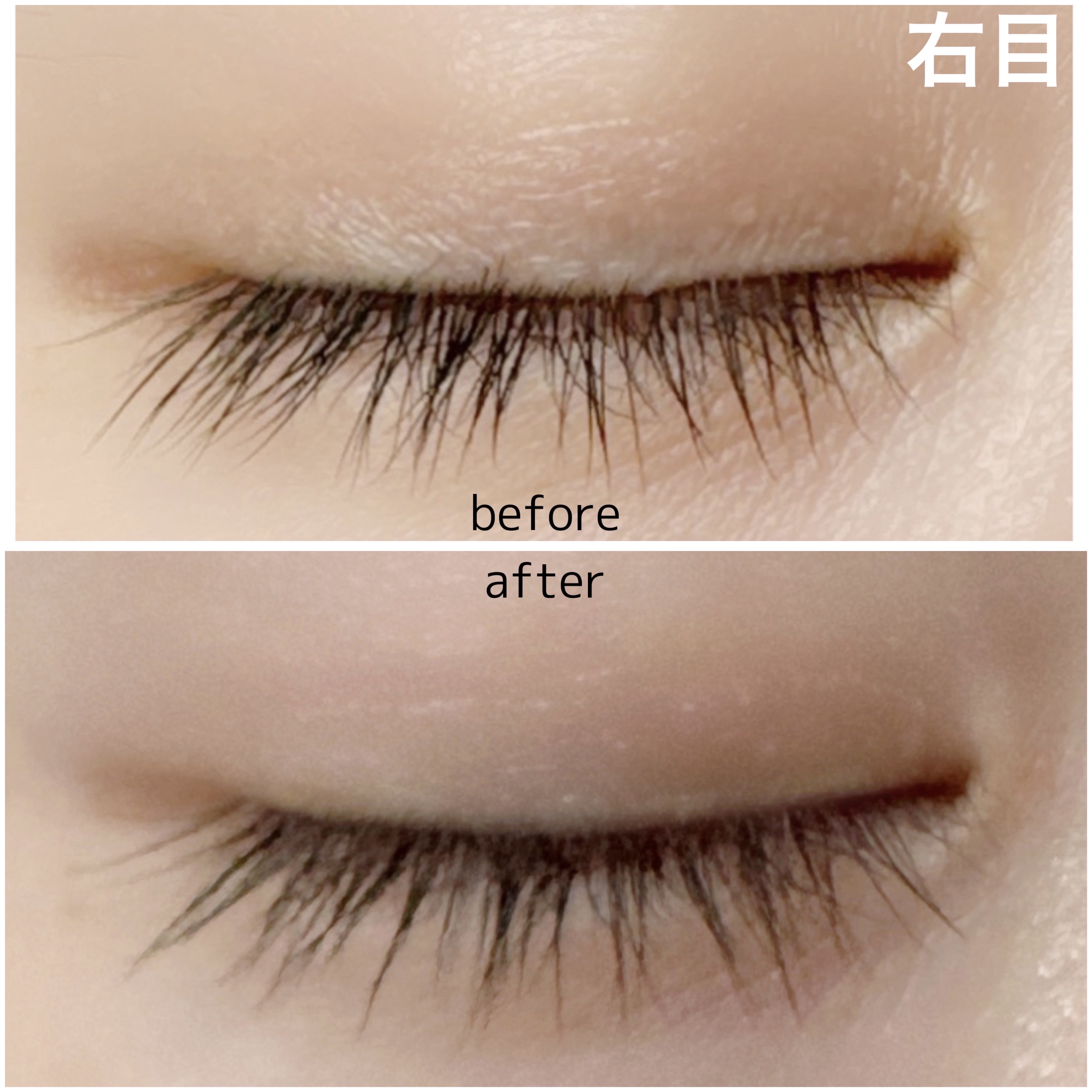 湘南美容まつ毛美容液/Co-medical+/まつげ美容液を使ったクチコミ（3枚目）