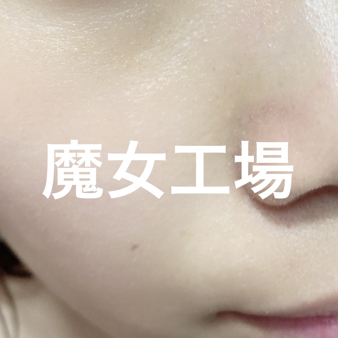 前回の投稿を見ていただければ
違いがわかると思います。


結果、めちゃ良いです。

ライン使い効果あるんかなー？とか
肌綺麗になるんかなー？とこ心配な時期もあったけど
明らかに毛穴が小さくなってる！

けど小鼻の赤みがまた出てきたような
