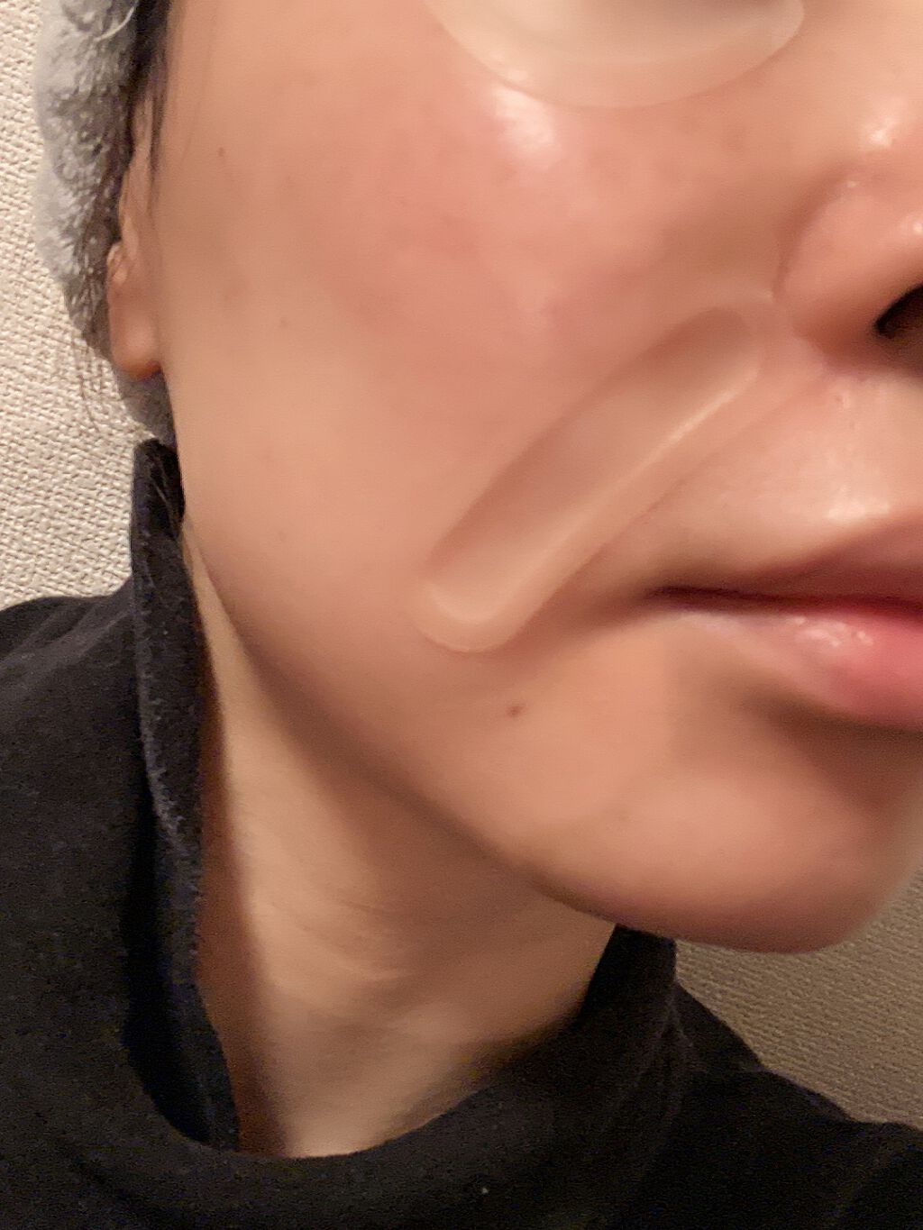 メディリフト 3Dマイクロフィラー(口元用)/YA-MAN TOKYO JAPAN/シートマスク・パックを使ったクチコミ(3枚目)